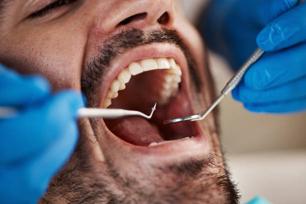 Best Emergency Treatment for Dental Infections or Abscesses in Coal Fork, WV